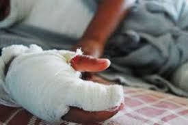 Joven sufrió graves quemaduras al pisar cable de media tensión en La Guajira.